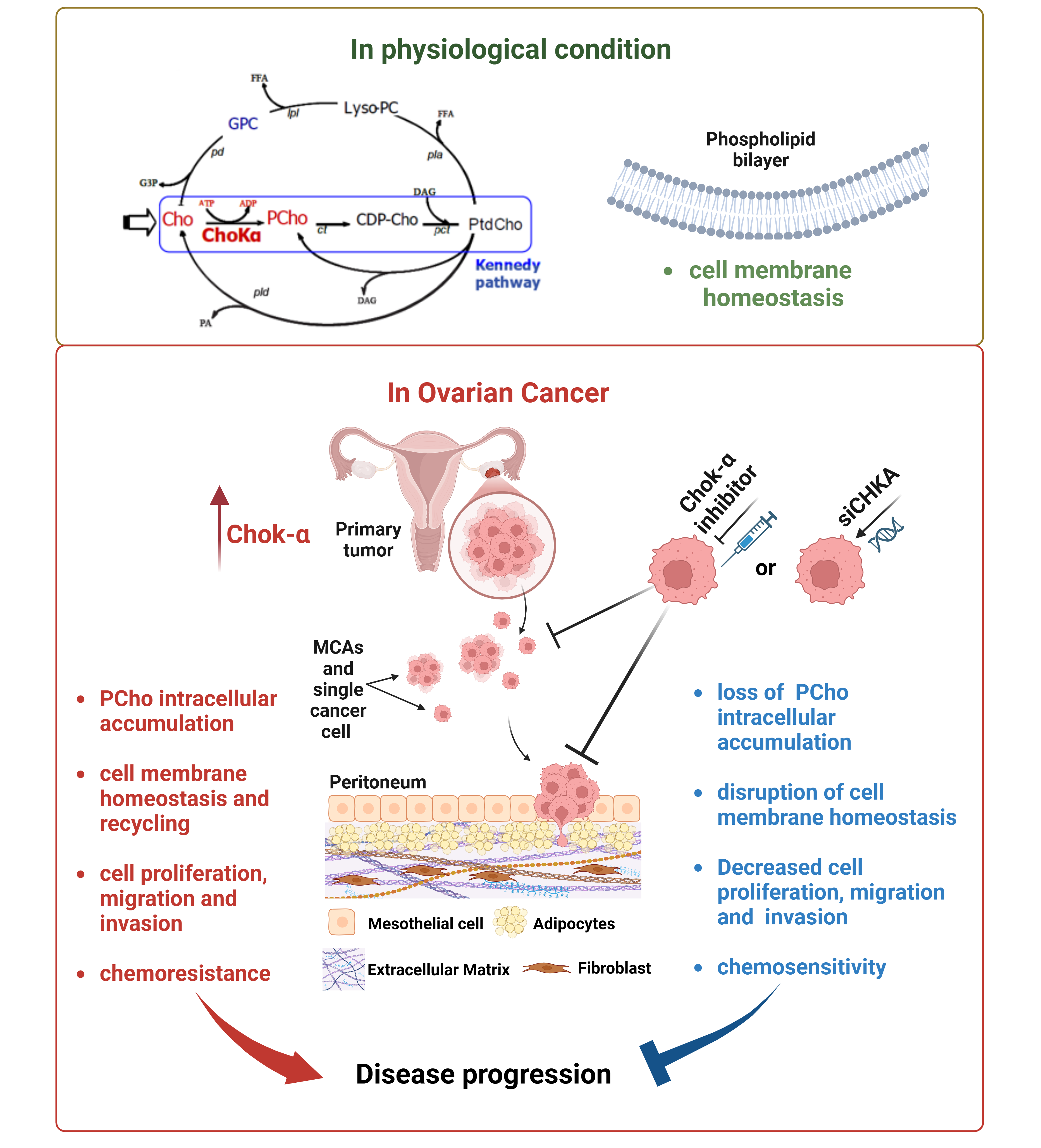 Exploring the involvement of choline kinase enzyme in ovarian cancer progression and dissemination
